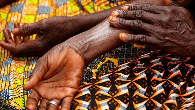 Benefits Of Shea Butter